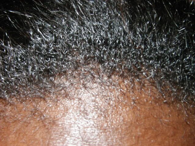hairlineshot.jpg